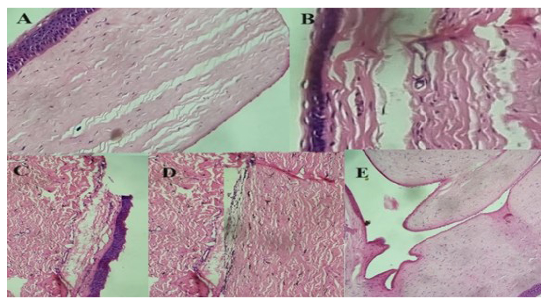 Light Microscopy of (A) Positive Control (1% w/v, SLS) and (B) MB4 (C) MB7, (D) MB10, (E) MB13 ,