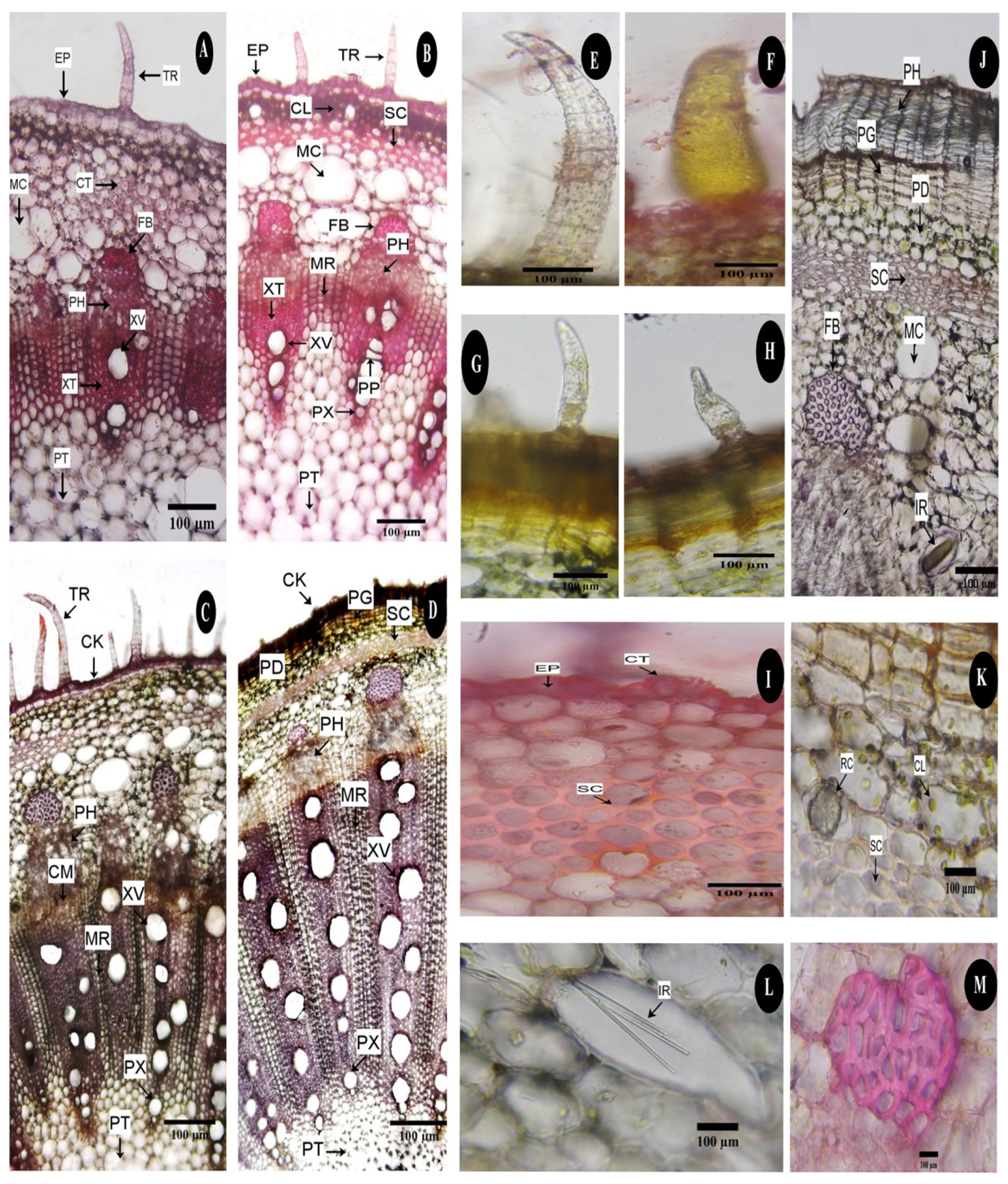 C. vitiginea L. stem structure. (Transverse sections). A-B: Primary structure; A. Young stem showing primary development of vascular bundles with wide cortex and pith, B. Thick layered epidermal formation with large mucilaginous canals; C-D: secondary structure; C. Cork layer formation and xylem secondary growth; D. Radial growth of vascular bundles. E-M: Enlarged view of epidermal and cortical portion. E-H: Trichomes; E. Multi-seriated non-glandular elongated trichomes on young stem; F. Unicellular glandular trichome on young stem; G and H. Morphologically diverse unicellular non-glandular trichomes seen on mature stem; I. Epidermal and subepidermal portion of young stem showing striated cuticle and sclerenchymatous layer; J-M: Details of mature stem; J. General aspects of matured stem; K. Subepidermal layers showing rosette crystals and chloroplast; L. Idioblast with raphides; M. Fibre bundle. (CT-Cuticle; EP-Epidermis; PH-Phellem; PG-Phellogen; PD-Phelloderm; SC-Sclerenchymatous layers; MC-Mucilaginous canal; FB-Fibre bundle; IR-Idioblast with raphides; CL-Chloroplast; RC-Rosette crystal; TR-Trichome; CK-Cork; CLCollenchymatous layer; CT-Cortex; PH-Phloem; CM-Cambium; MR-Medullary rays; XV-Xylem vessel; XT-Xylem tracheids; PX-Primary xylem; PT-Pith; PP-Perforation plate).