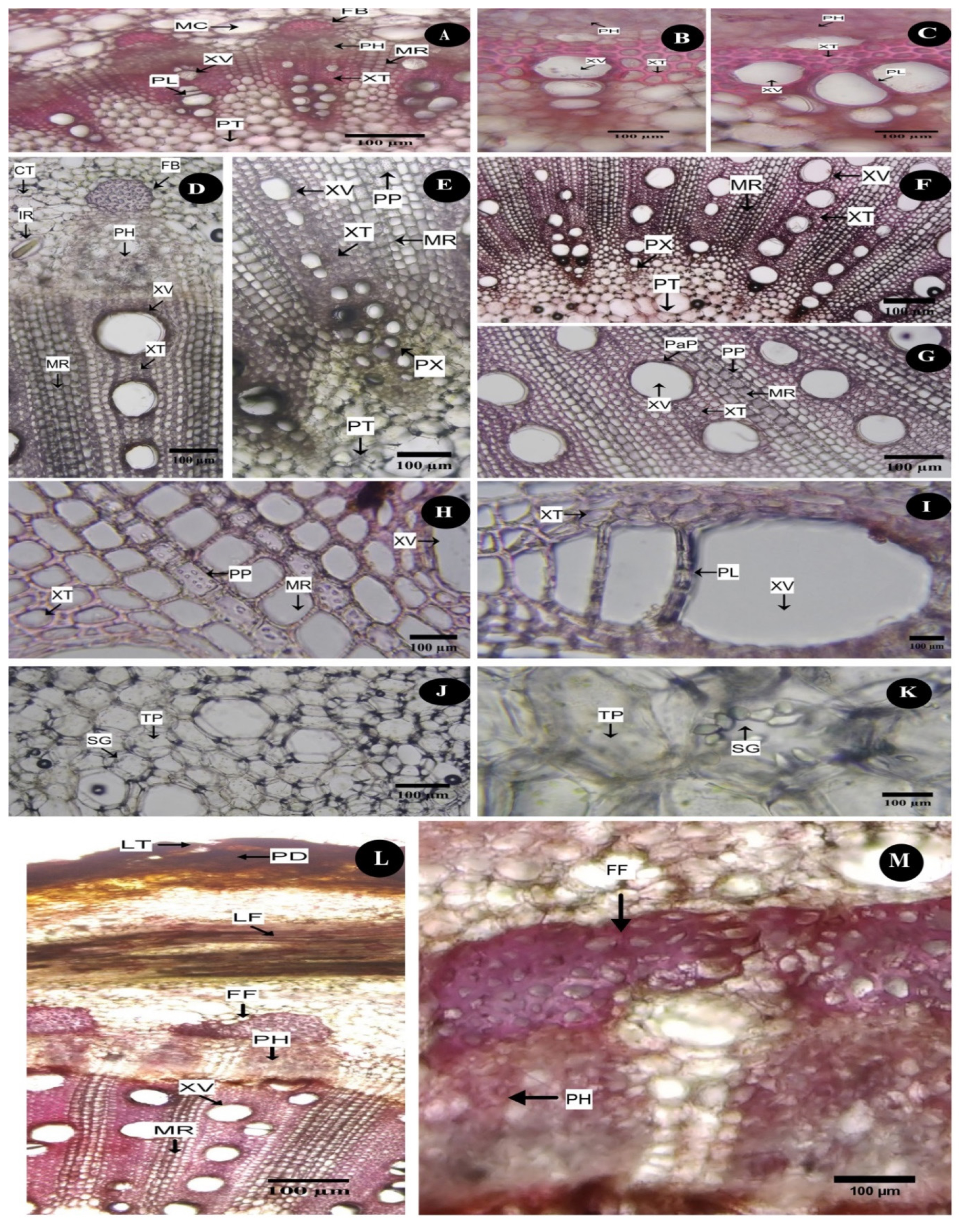 C. vitiginea stem-Vascular system and Nodal anatomy. A-C: Primary development of vascular bundle of young stem; A-Radially arranged vascular system showing smaller bundles with prominent xylem and phloem elements; B-Uniserite bundle; C-Multiseriate bundle; D-K: Details of vascular system and pith of mature stem; D-enlarged view of single vascular bundle with secondary growth; E-Enlarged view of the central portion of the transverse section of stem; F-Radially arranged xylem vascular bundles; G-Enlarged view of radially arranged xylem elements; H-Xylem elements showing pitted parenchyma; I-J: Xylem vessel with perforation; K-Pith cells contain clusters of starch grain, L-Transverse section of stem nodal region showing periderm with lenticel and cortex region with leaf trace and fused fibre bundles above the vascular bundles, M-Enlarged view of fused fibre bundles (MC-Mucilaginous canal; FB-Fibre bundle; IR-Idioblast with raphides; CT-Cortex; PH-Phloem; MR-Medullary rays; XV-Xylem vessels; XT-Xylem tracheids; PL-Perforation plate; PT-Pith; PP-Pitted parenchyma; PaP-Paratracheial axial parenchyma; PX-Protoxylem; TP-Thin-walled parenchyma; SG-Starch grains; LT-Lenticel; PD-Periderm; LF-Leaf trace; FF-Fused fibre).