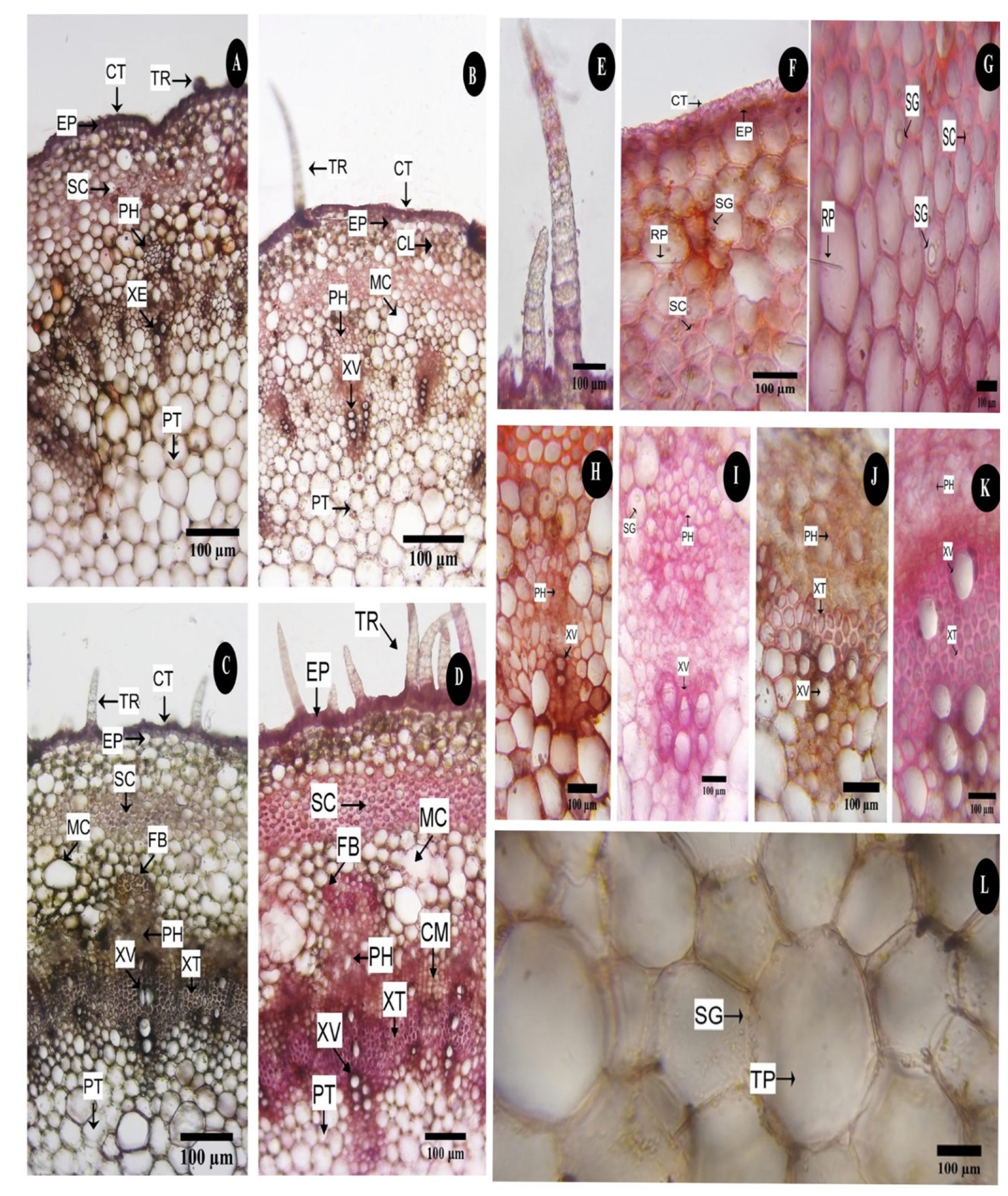 C. vitiginea L. tendril structure detailed with stages of vascular system development (Transverse sections). A-D: Anatomy of different parts of tendril showing growth stages. A-distal region of tendril; B-Median region of tendril; C-Mature tendril with prominent development of xylem elements; D-Base of a mature tendril showing anatomy similar to the secondary growth of stem, E-F: Epidermal details of young tendril; E-Elongated biserite non-glandular trichomes; F-Enlarged view of epidermal portion showing striated cuticle; G-Sub-epidermal portion showing sclerenchymatous layers with starchgrains and raphides; H-K: Developmental stages of vascular system; H-Initial stage of vascular system development showing a uniseriate xylem vessel and phloem elements; I-Vascular bundle with triseriate xylem vessel; J-Xylem trachiery elements started to develop in between phloem and xylem vessels; K-Well developed vascular bundle with prominent trachiery elements; L-Pith composed of thin-walled parenchyma with starch grains (TR-Trichome; CT-Cuticle; EP-Epidermis; CL-Chollenchymatous layer; CM-Cambium; FB-Fibre bundle; MC-Mucilaginous canal; RP-Raphides; SG-Starch grains; SC-Sclerenchymatous layer; PH-Phloem; XE-Xylem element; XV-Xylem vessels; XT-Xylem tracheids; PT-Pith; TP-Thin-walled parenchyma).