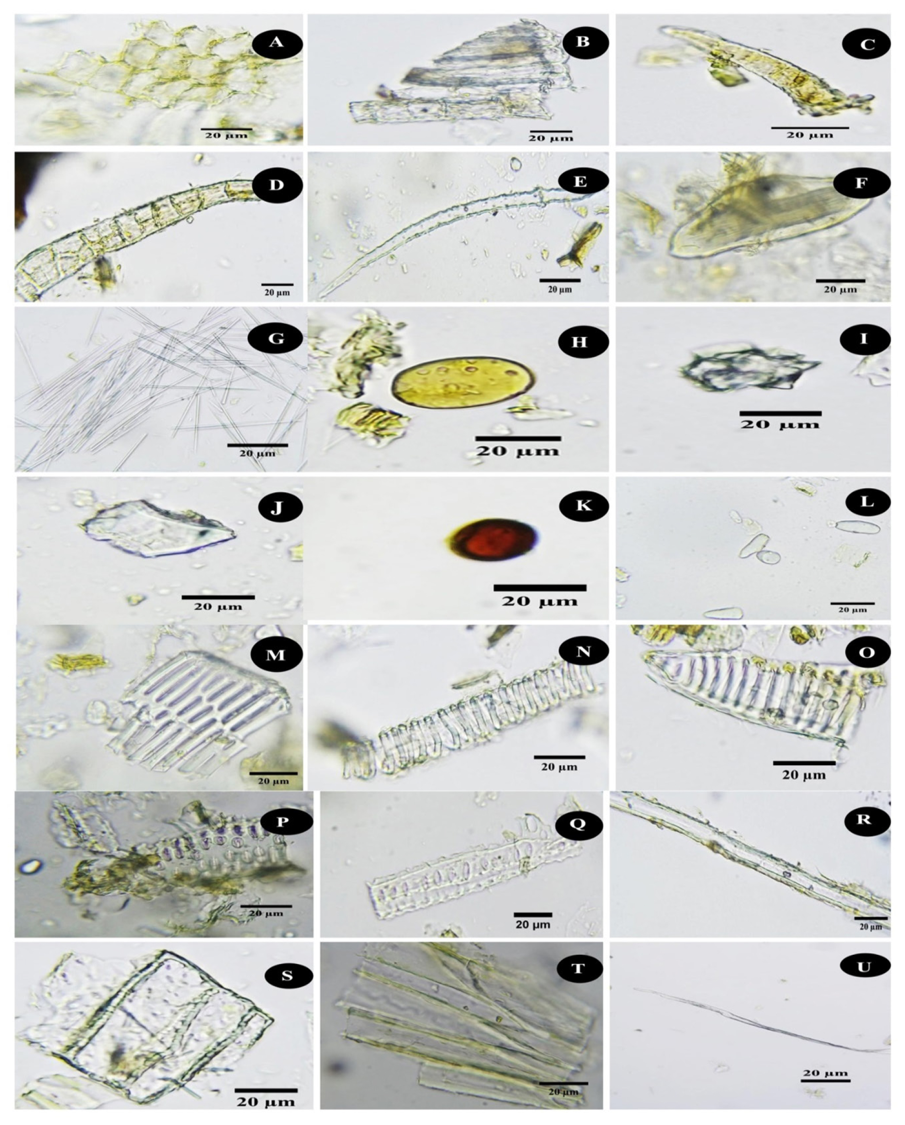 Powder microscopic characters of stem of C. vitiginea L. A: thin-walled parenchyma fragment, B: xylem parenchyma cells, C: uniseriate non-glandular trichome, D: biseriate non-glandular trichome, E: warty trichome, F: idioblast with raphides, G: acicular crystal, H: oil cell, I: rosette crystal, J: prismatic calcium oxalate crystal, K: tannin content, L: starch grains, M: reticulate vessel, N: spiral vessel fragment, O: annular tracheid, P: boardered pitted vessel, Q: simple pitted vessel, R: thick-walled tracheid with narrow lumen, S: xylem pitted parenchyma, T: lignified fibre bundle, and U: fibre.