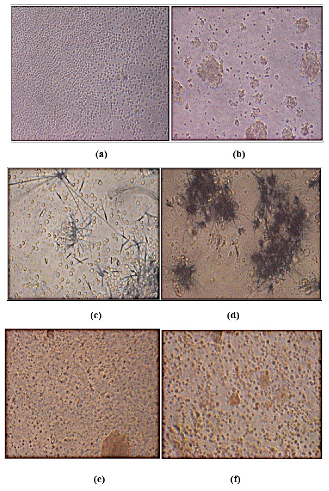 (a) Media control after 72hr drug expose. (b) PHA after 72hr drug expose. (c) Media control after crystal Formazen. (d) PHA after crystal formazen. (e) HEEGH 0.06 mg after 72 hr expose (Lymphocytes toxicity). (f) HEEGH 1 mg after 72 hr expose (Lymphocytes toxicity).