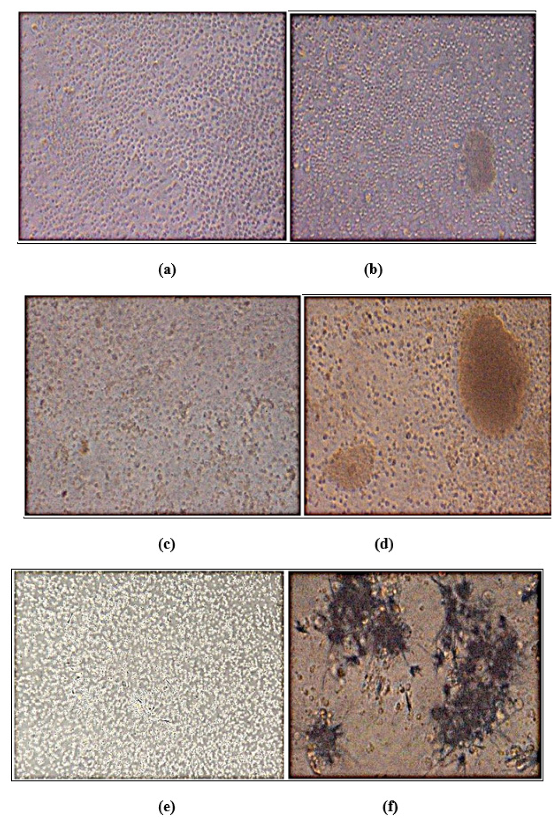 (a) STD (Levamisole, 10mg) after 72 hr expose. (b) STD (Levamisole, 100 mg) after 72 hr expose. (c) HEEGH 0.06 mg after 72 hr expose (Lymphocyte Proliferation). (d) HEEGH 2 mg after 72 hr expose (Lymphocyte Proliferation). (e) Lymphocytes under 10x magnification. (f) MTT metabolization by proliferating lymphocytes 40x magnification.
