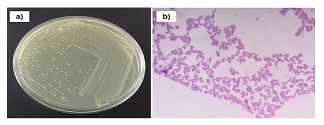 a. Single screened colonies of isolate B-51 and b. Microscopic observations of isolate B-51 after Gram’s staining (100 x magnification).