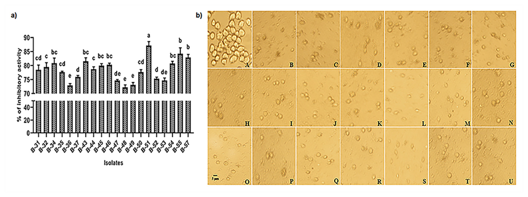 a. Inhibitory activity of bacterial isolates against Entamoeba histolytica, human pathogen and b. Anti-amoebic activity: A. Control where trophozoites in amoeboid shape. B-U. Co-culture with 1010 bacterial cells/mL of isolates of B-31 to B-57: Decreased number of trophozoites due to killing activity of isolates.