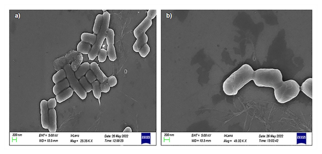Scanning electron microscopy. Morphology of isolate B-51 (a) and B-55 (b).