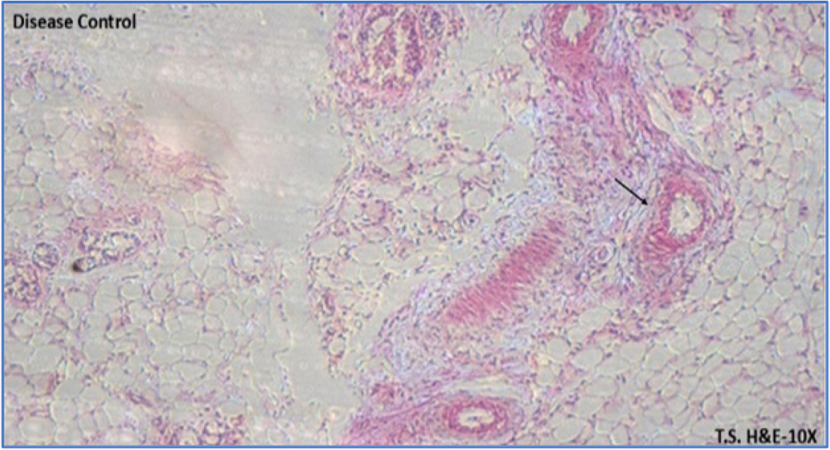 Disease Control. The image shows abnormal skin architecture with mild signs of inflammation or granuloma formation (small, round cells with dark nuclei-black arrow). There's an unusual arrangement of skin layers and the presence of inflammatory cells.