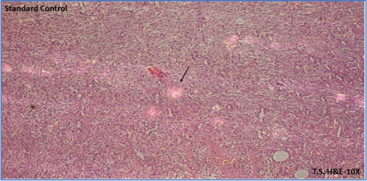 Standard Control. The image shows moderate fibrosis (black arrow), a mild inflammatory response, and preserved tissue architecture. This suggests that the standard treatment promotes a balanced tissue response with controlled fibrosis and inflammation. The vascular structures are better maintained, indicating less disruption and better tissue health compared to the disease.