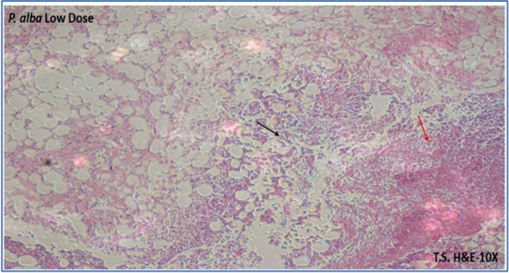 P. alba (250 mg/kg). The image shows dense connective tissue, indicating significant fibrosis and tissue remodelling. The dense fibrotic tissue is characterized by a high number of cells, suggesting an intense inflammatory response. Ruptured blood vessels (black arrow) and mild inflammation is seen (red arrow).