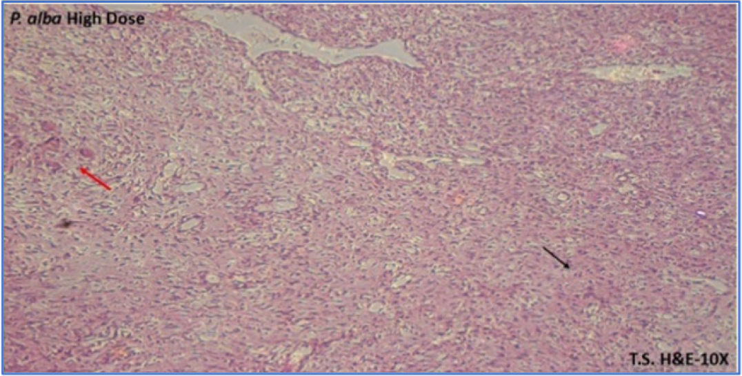 P. alba (500 mg/kg). The image shows moderate fibrosis, a mild inflammatory response (red arrow), and preserved tissue architecture. The tissue appears less dense and less fibrotic. Vascular structures are visible, indicating the tissue has maintained some normal architecture and blood supply (black arrow).