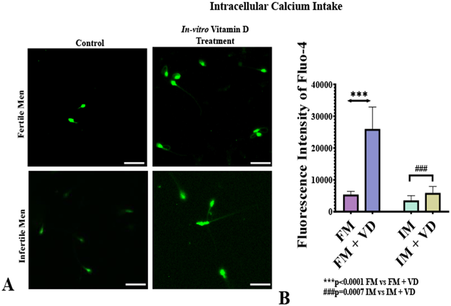 Calcium Mobilization. A: Fluo-4 AM staining of sperm from Fertile (FM) and infertile men (IM) with and without in vitro vitamin D treatment, indicating intracellular calcium mobilization (green fluorescence). Vitamin D treatment increased calcium uptake in both groups. B: Bar chart showing Corrected Total Cell Fluorescence (CTCF) of sperm from FM and IM with and without 1 nM vitamin D treatment (statistical significance assessed using paired t-test). Values are mean ±SD, n=20. Magnification: 40X, Scale bar: 100 µm. Abbreviations: FM=Fertile men; FM + VD=Fertile men with in vitro vitamin D treatment; IM=Infertile men; IM + VD=Infertile men with in vitro vitamin D treatment.