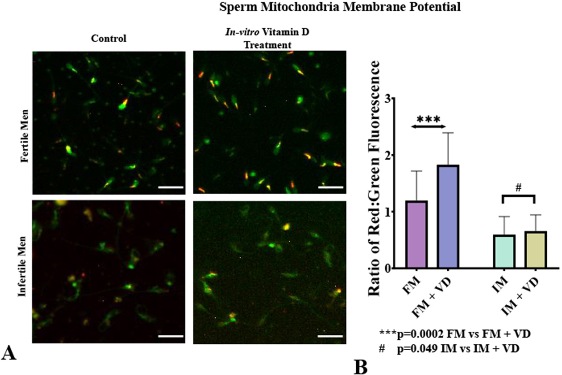 Mitochondrial Membrane Potential. A: Fluorescence microscopy using MitoPT JC-1 to assess sperm mitochondrial membrane potential in Fertile (FM) and Infertile Men (IM) with and without in vitro vitamin D treatment. Orange-red fluorescence indicates hyperpolarized cells, while green fluorescence indicates depolarized cells. B: Bar chart showing the ratio of red to green fluorescence for sperm from FM and IM with and without 1 nM vitamin D treatment (statistical significance assessed using paired t-test). Values are mean±SD, n=20. Magnification: 40X, Scale bar: 100 µm. Abbreviations: FM=Fertile men; FM + VD=Fertile men with in vitro vitamin D treatment; IM=Infertile men; IM + VD=Infertile men with in vitro vitamin D treatment.