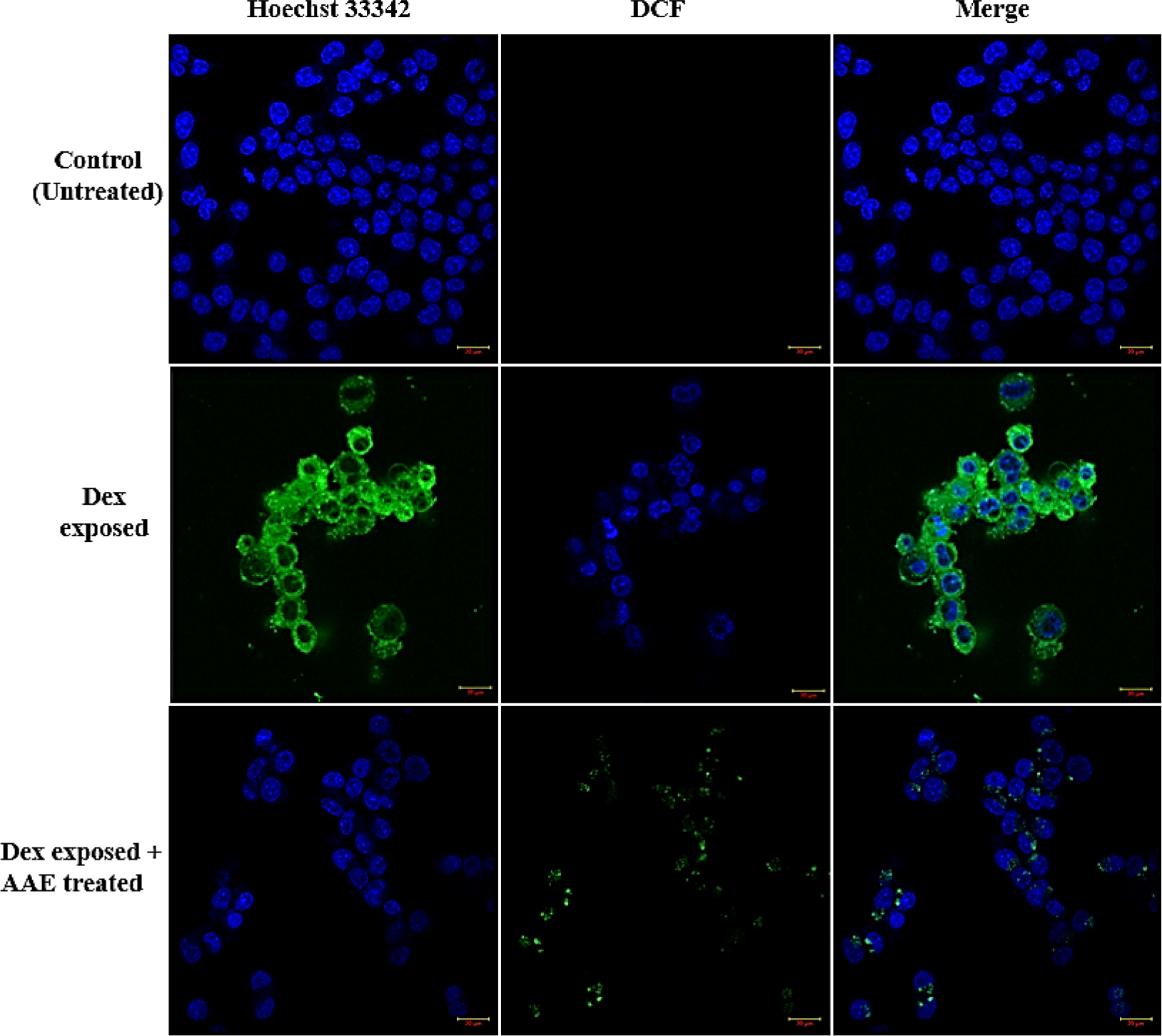 AAE’s Protective Role Against Dexamethasone-Induced Stress in SH-SY5Y Cells.