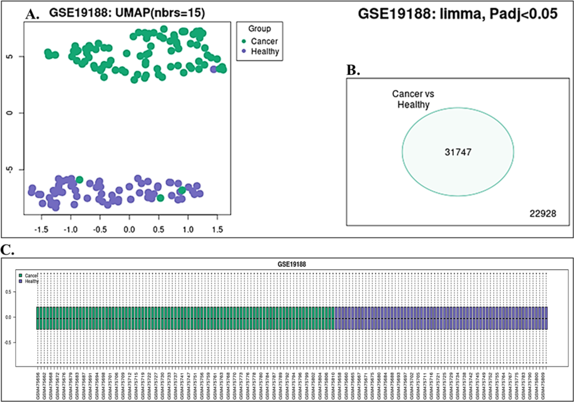 (A) Umap anlaysis of dataset of GSE33532 (B) Cluster analysis of dataset of GSE33532 (C) Boxplot analysis of dataset of GSE19188.