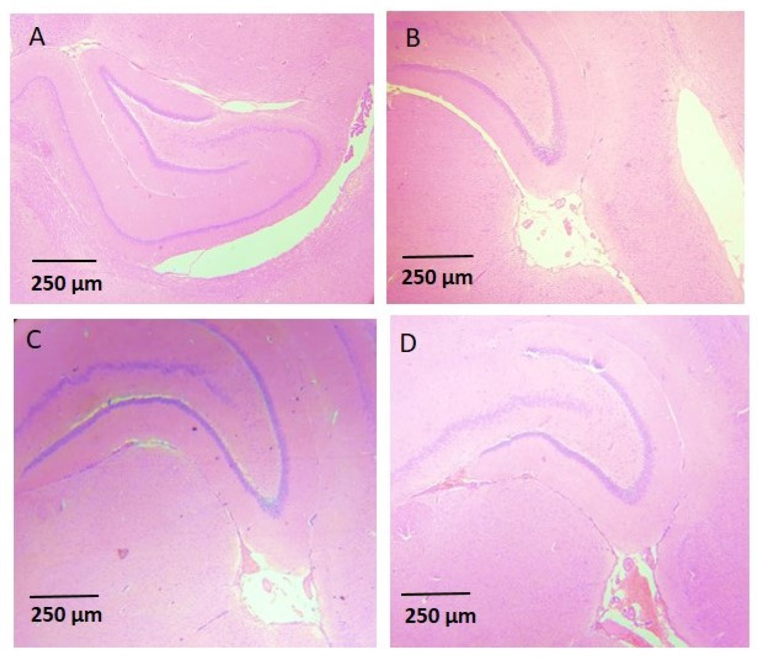Histological sections of the Paraventricular nucleus of hypothalamus of rats. A Normal rat, B mety 100 mg/kg, C mety 150 mg/kg and D mety 200 mg/kg. No observable changes like neuronal degeneration, vascular changes or gliosis, and inflammation in all the groups.