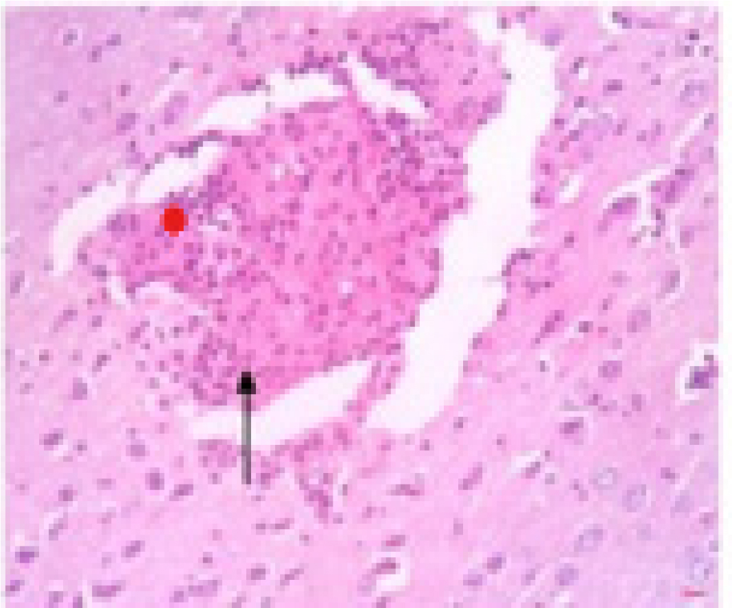 Histological exam forALSNs.
