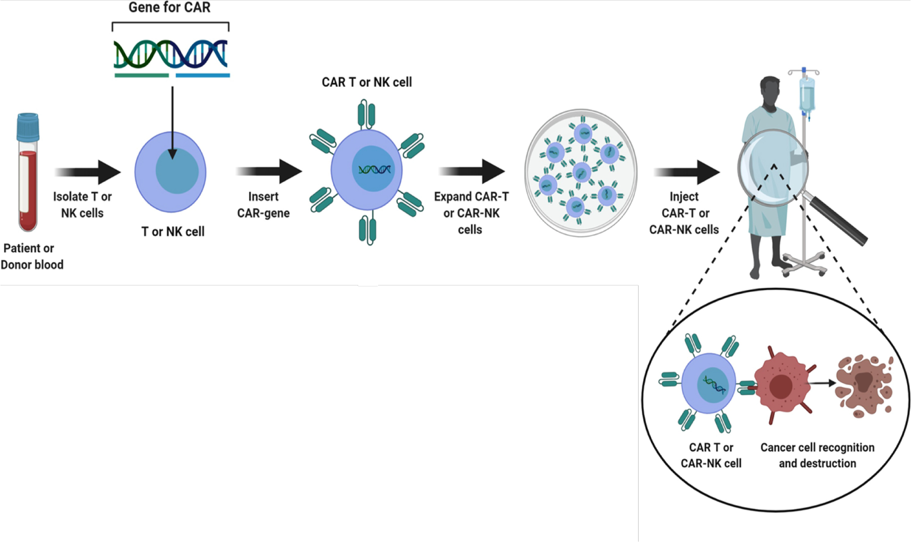 CAR-T and NK cell therapy in cancer treatment (From the patient or the donor blood, T or NK cells are harvested. Then the cells are genetically engineered to express Chimeric Antigen Receptors (CARs). Expanding CAR-T or CAR-NK cells until there are enough for injection back into the patient, where they can help fight cancer cells) (Saenz-Antoñanzas et al., 2021).