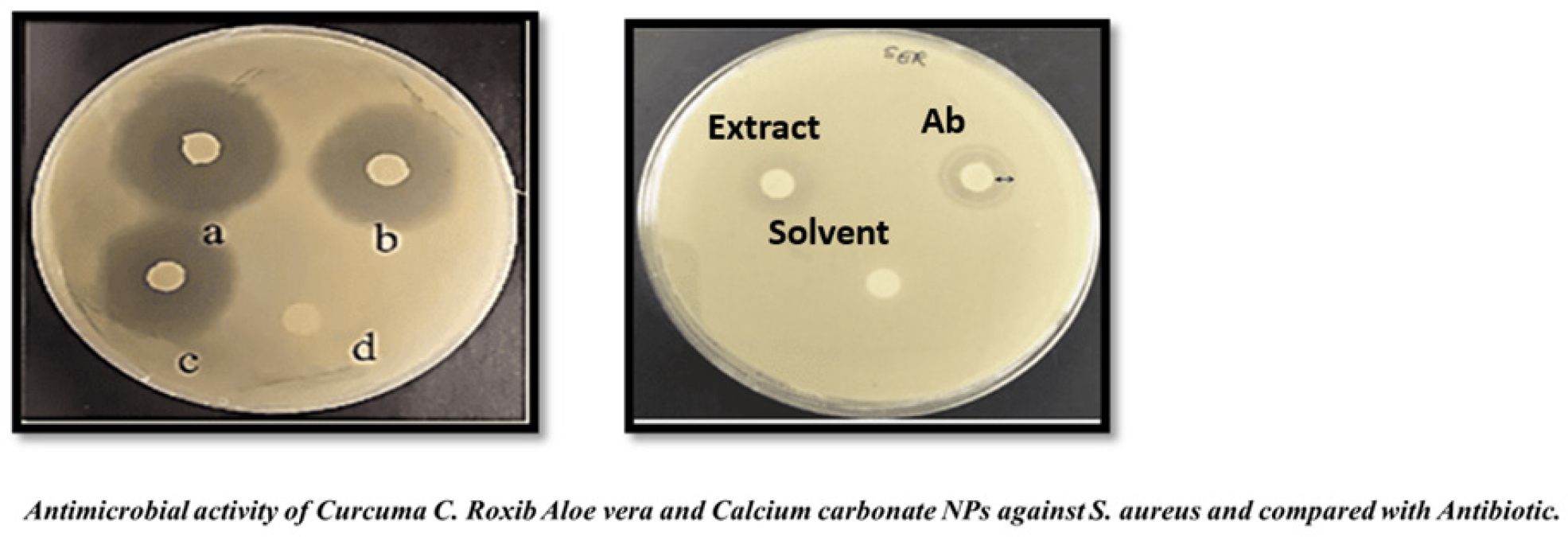 Anti-microbial in vitro studies for Curcuma caesia Roxb., Aloe vera, and Calcium carbonate nanoparticles.