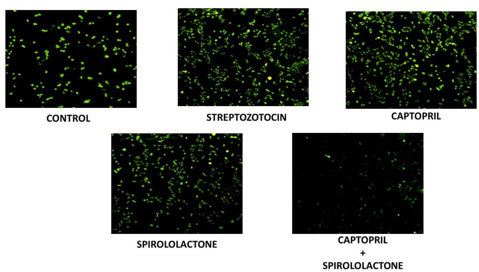 DCFDA Staining for KGN cells to measure ROS levels.
