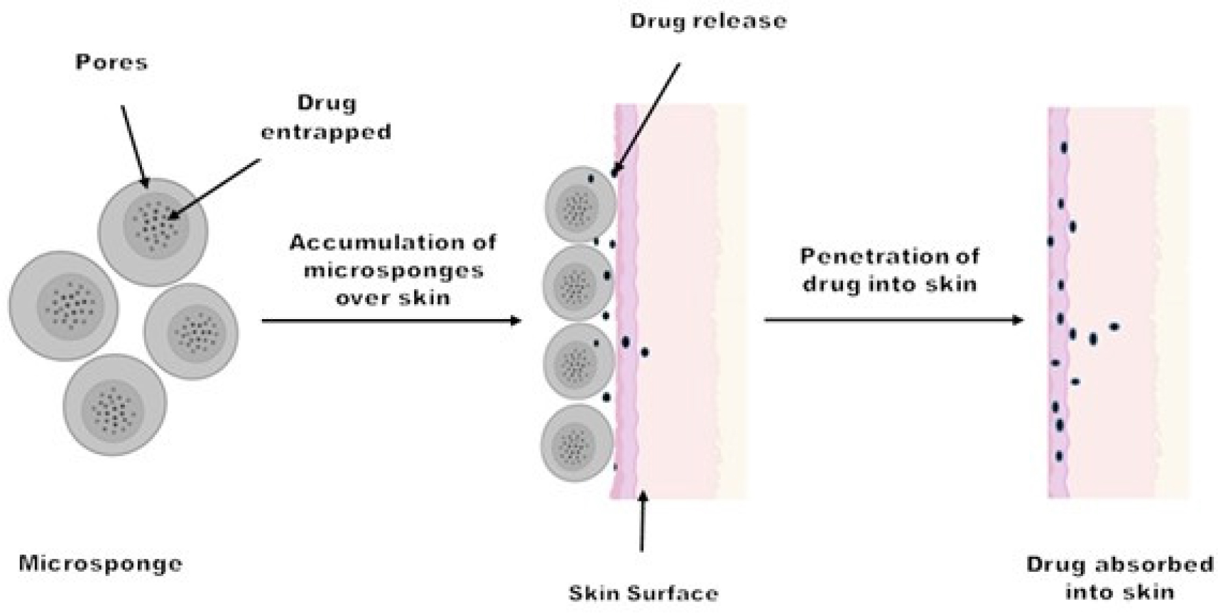 Quasi-emulsion solvent diffusion method.