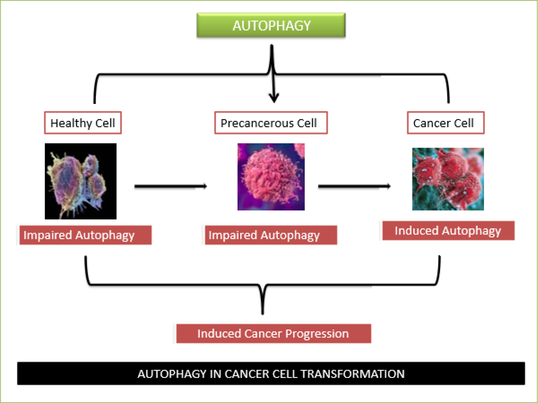 Autophagy in Cancer Cell Transformation.