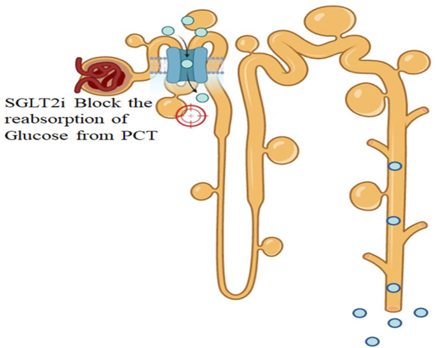 Mechanism of SGLT2i Diabetes Mellitus.