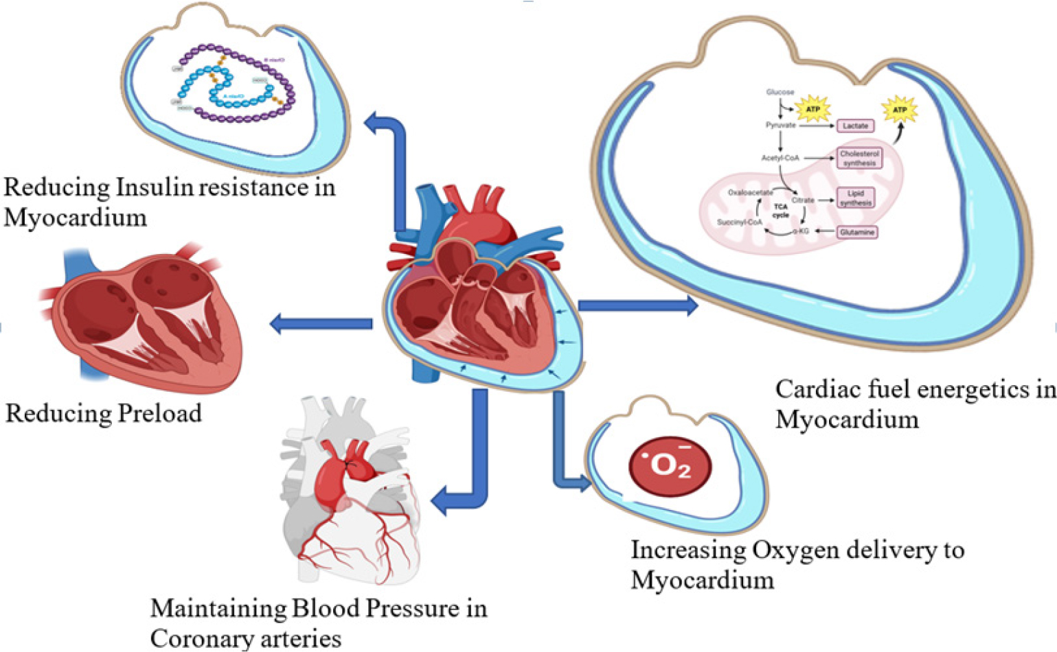 Multidimensional mechanism of SGLT2i on Heart.