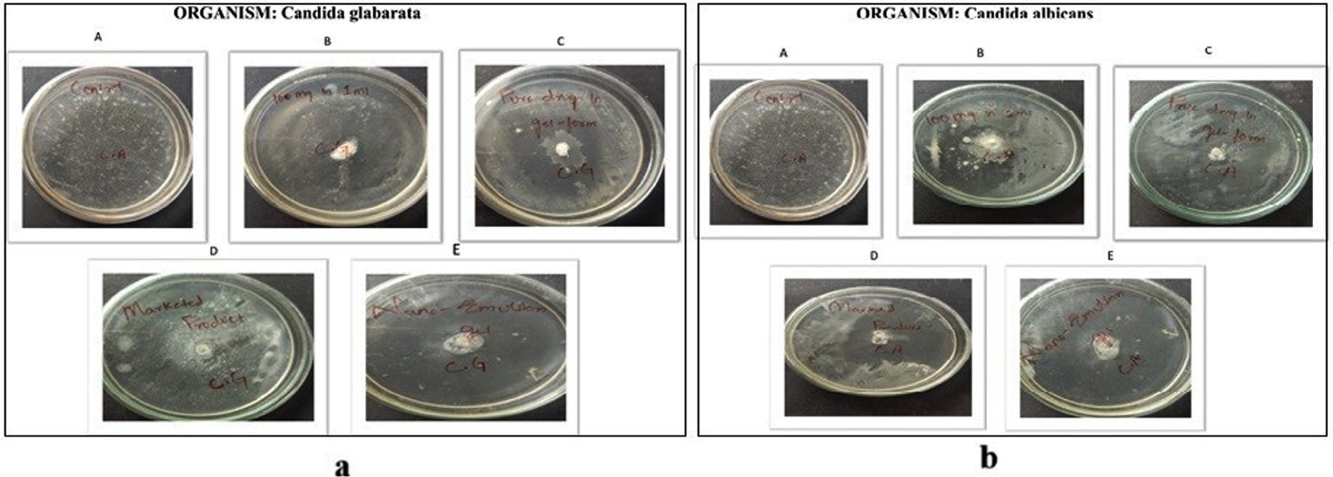 Antifungal studies against (a) Candida glabrata and (b) Candida albicans; A-Control; B-Pure Drug; C-Pure Drug in Gel form; D-Marketed preparation; E-Nanoemulsion gel.