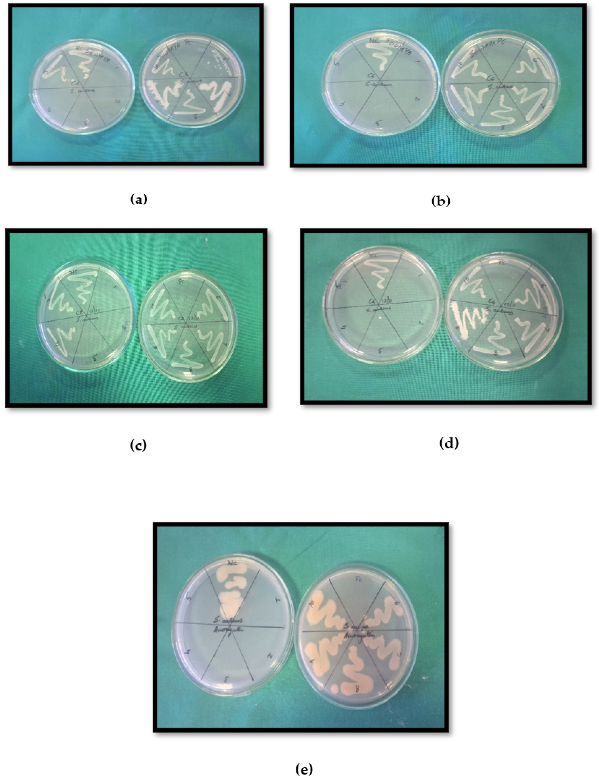 Gram +ve bacteria (S.aureus); a-C3, b-C6, c-C2, d-C4, e-std.drug (Amoxicillin).