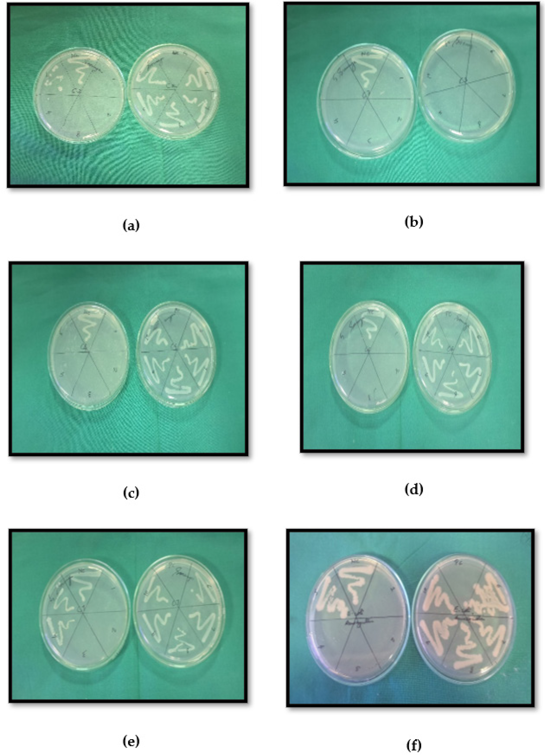 Gram -ve bacteria (E.coli); a-C2, b-C3, c-C4, d-C6, e-C7, f-std.drug (Amoxicillin).