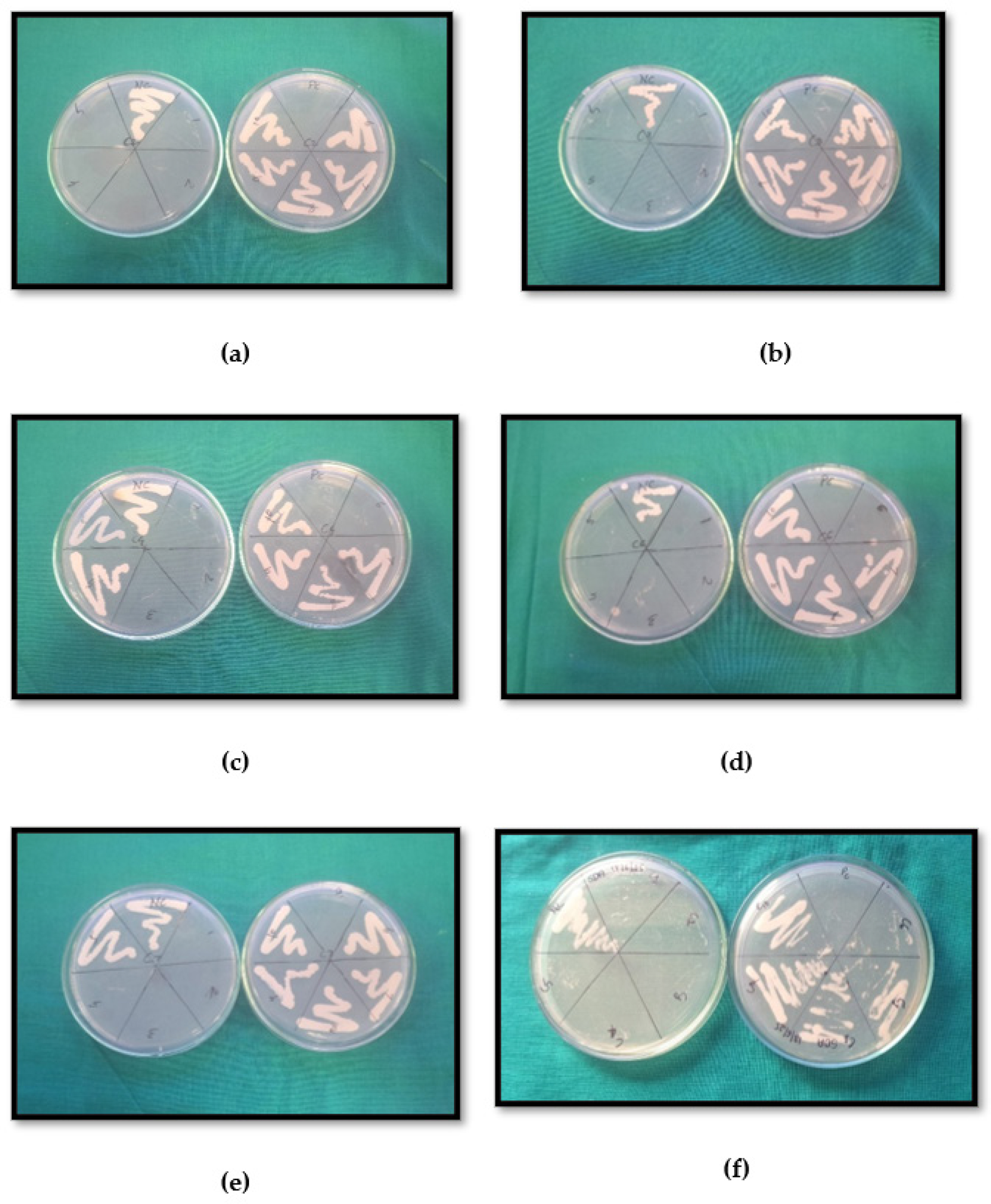 Antifungal activity (C. albicans); a-C2, b-C3, c-C4, d-C6, e-C7, f-std.drug (Fluconazol).