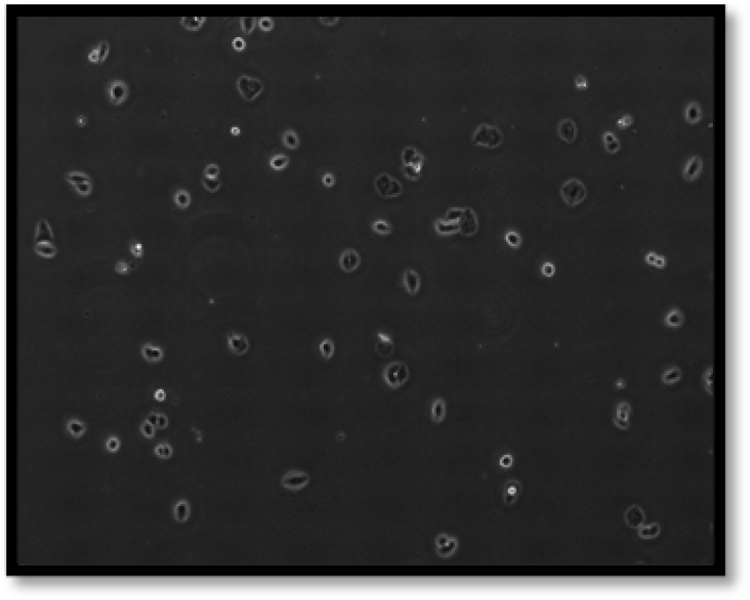 Microscopic image of Calu-3 cells.