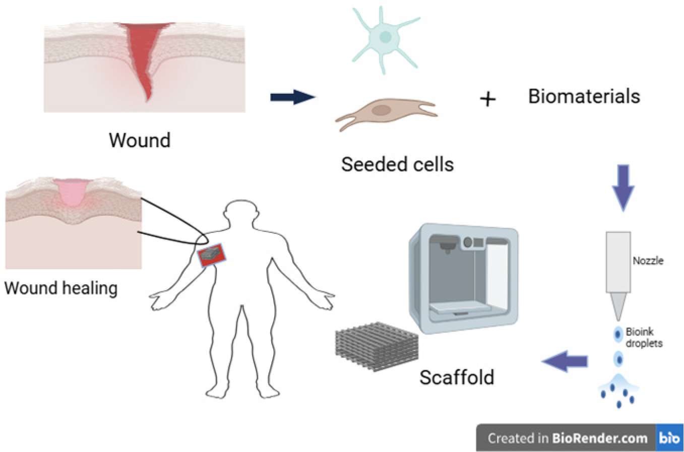 Outline of skin tissue engineering by 3D printing (created by Biorender).