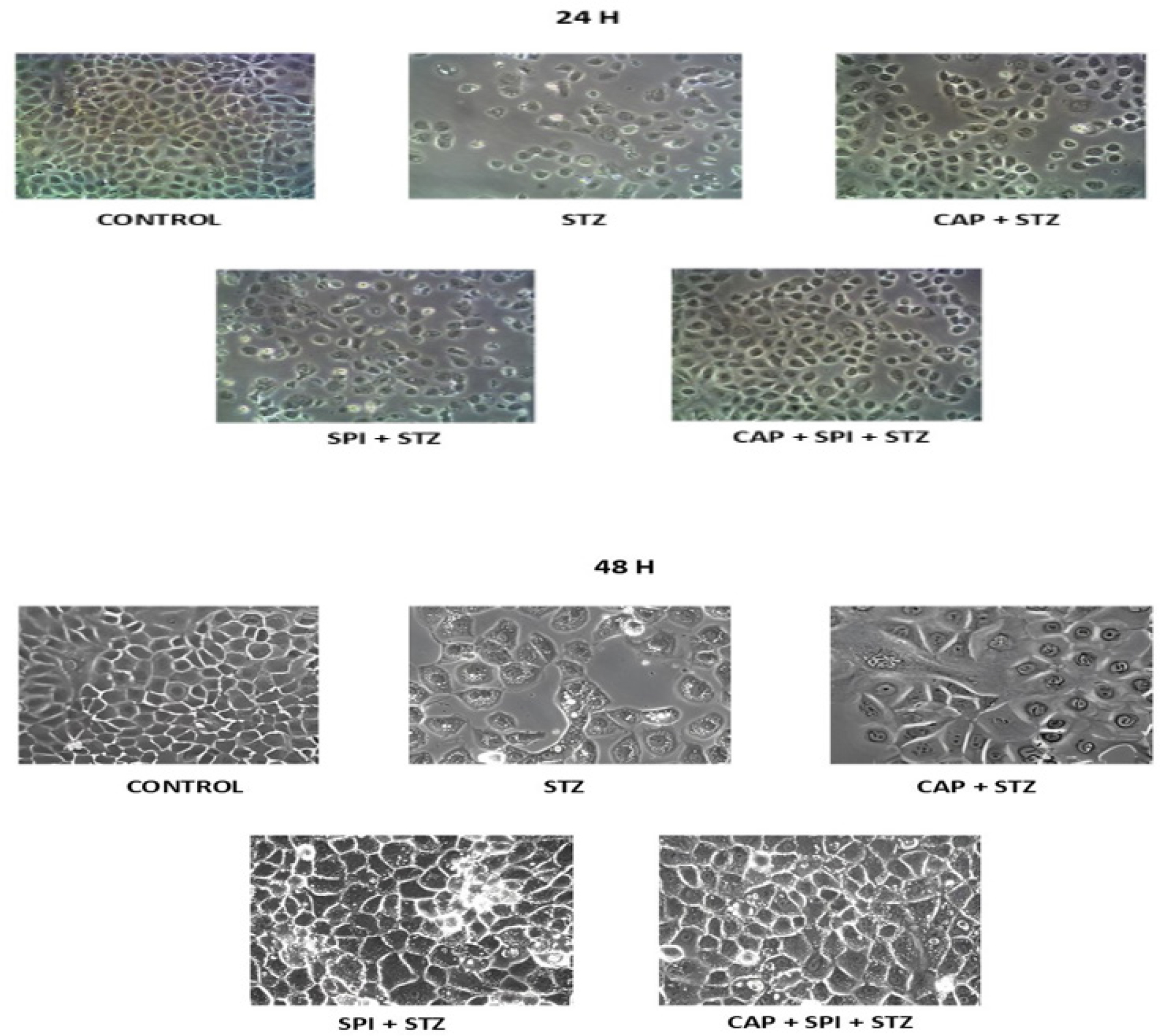 Morphological assay of NRK-52E cells under 100× phase contrast microscopy (24 hr, 48 hr) with spironolactone, captopril, and their combination.
