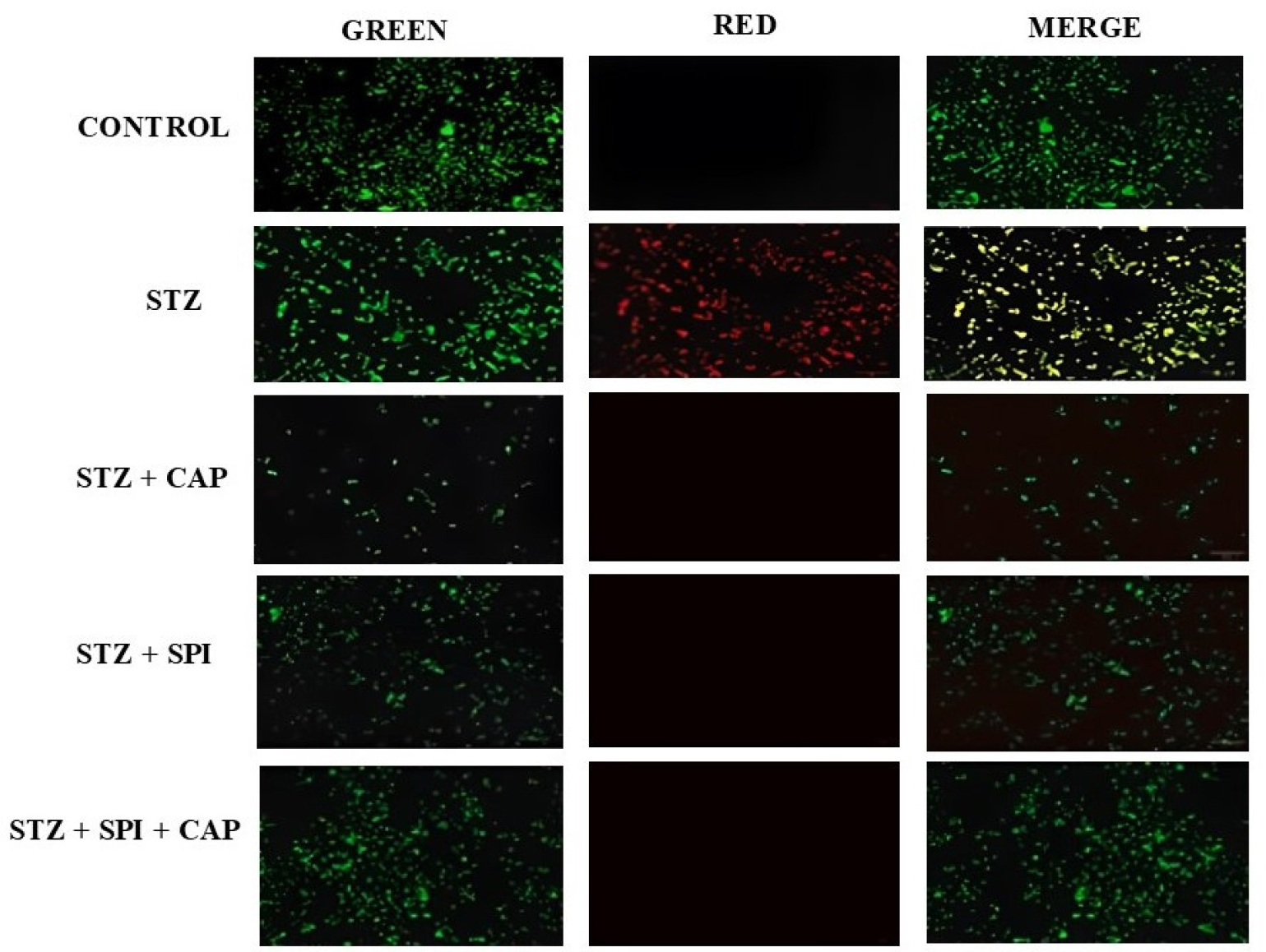Fluorescence staining of NRK-52E cells with Captopril, Spironolactone and their co-treatment.
