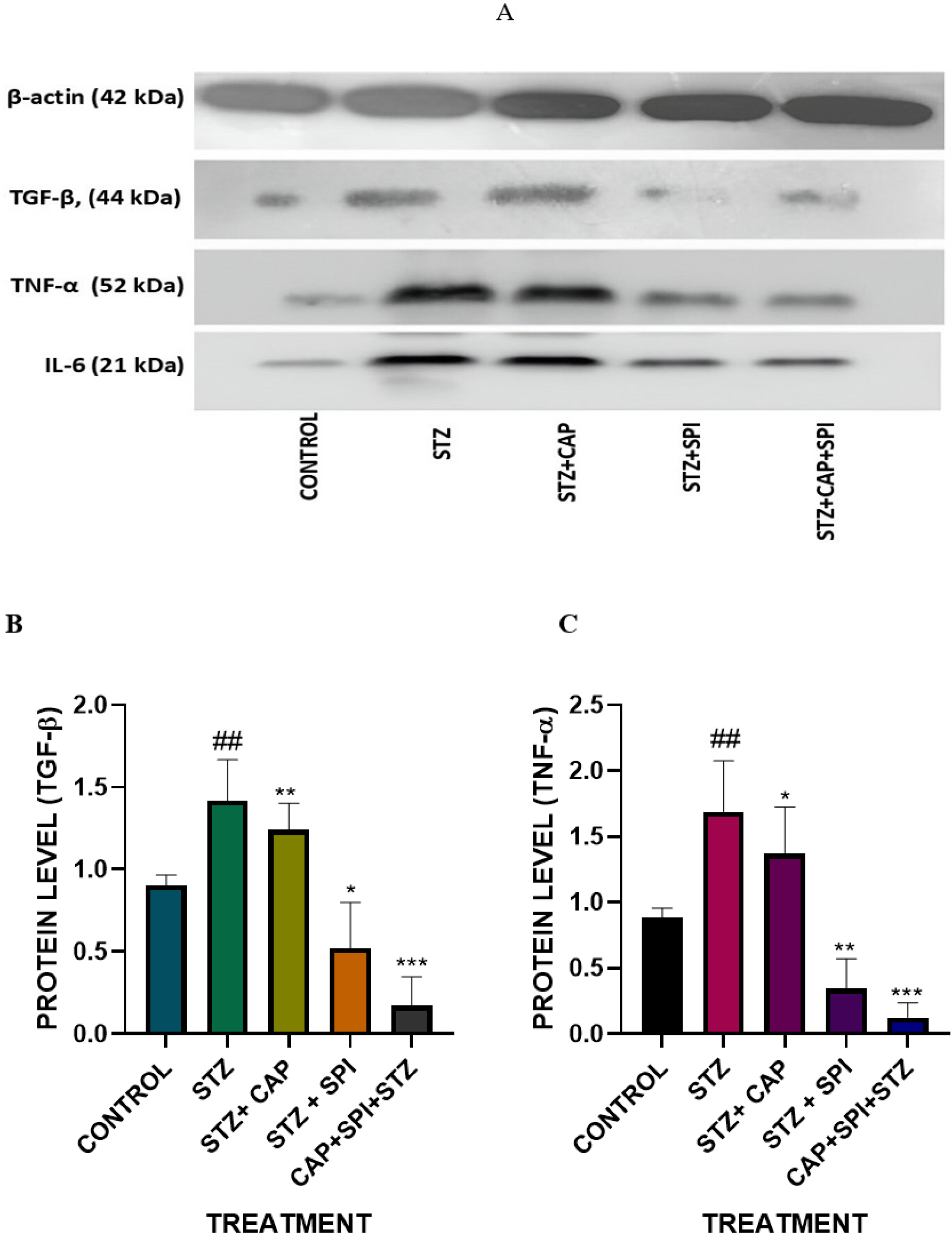 (A) Western blot analysis showing expression levels of TNF-α, IL-6, and TGF-β in STZ-treated NRK-52E cells, with β-actin as the loading control. (B-D) Quantitative graphs depict the synergistic anti-inflammatory effects of treatments. Data are presented as mean ± SEM (n = 3). Statistical analysis was performed using one-way ANOVA followed by Tukey’s post hoc test. *p < 0.05 vs control group; #p < 0.05 vs STZ-treated group.