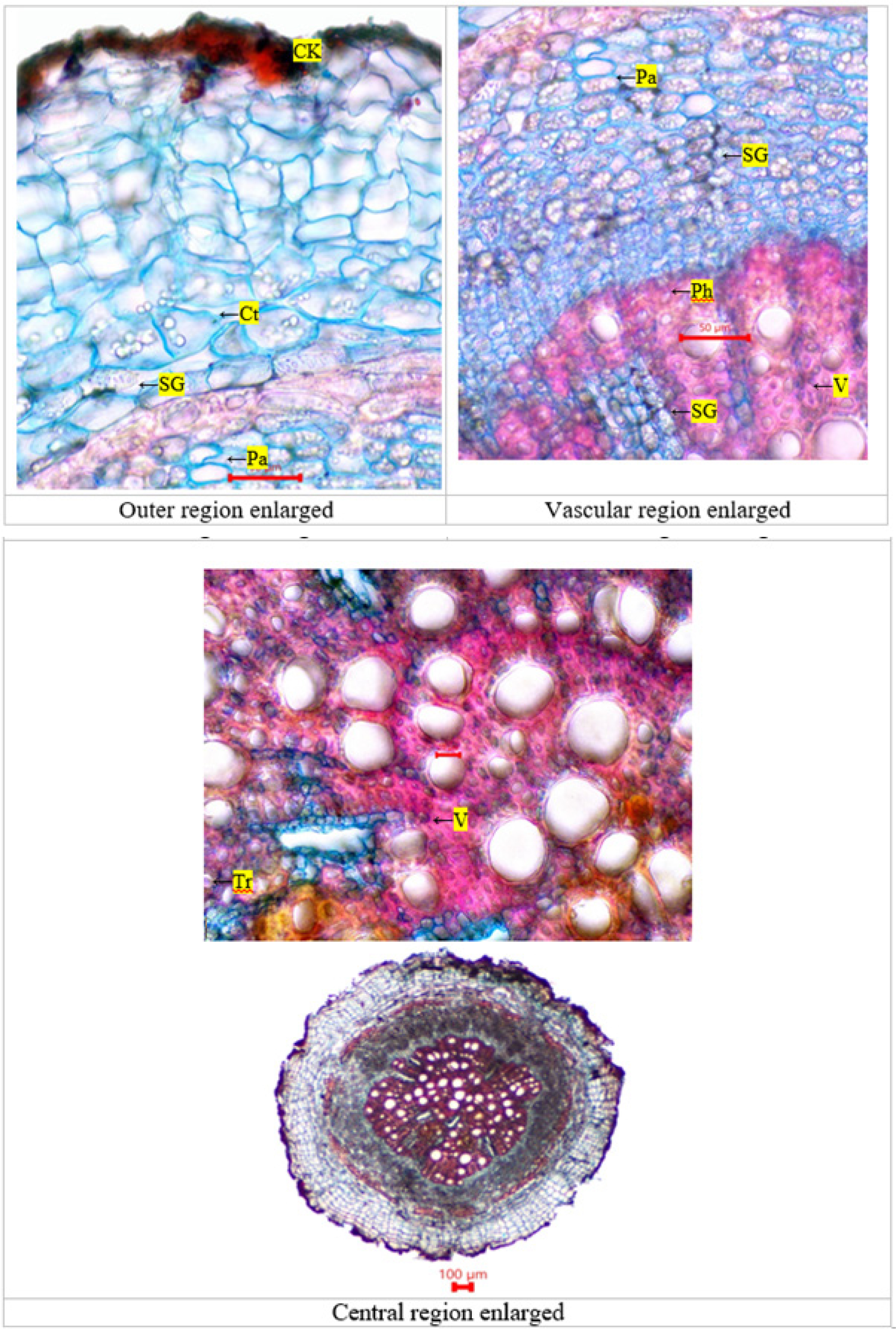 TS of Pergularia daemia-root. Ck - cork; Cot - cortex; Pa - parenchyma; Per - pericycle; Ph - phloem; SG - starch grain; Tr -tracheid; V - vessel; Xy – xylem.