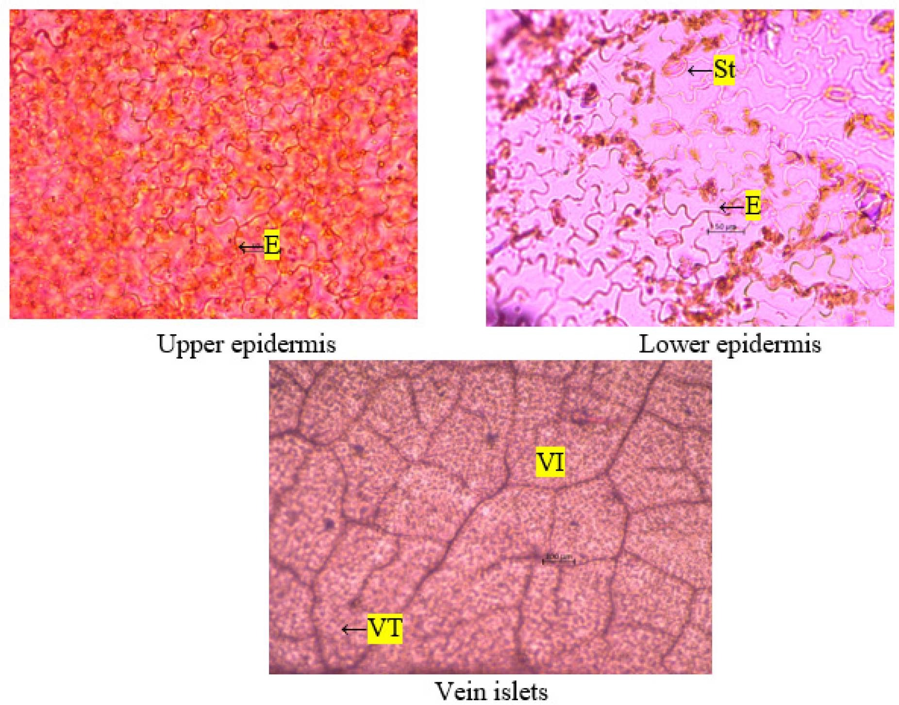 Quantitative microscopy ofPergularia daemia – leaf. E - epidermis; St - stomata; VI - vein islet; VT - vein termination.