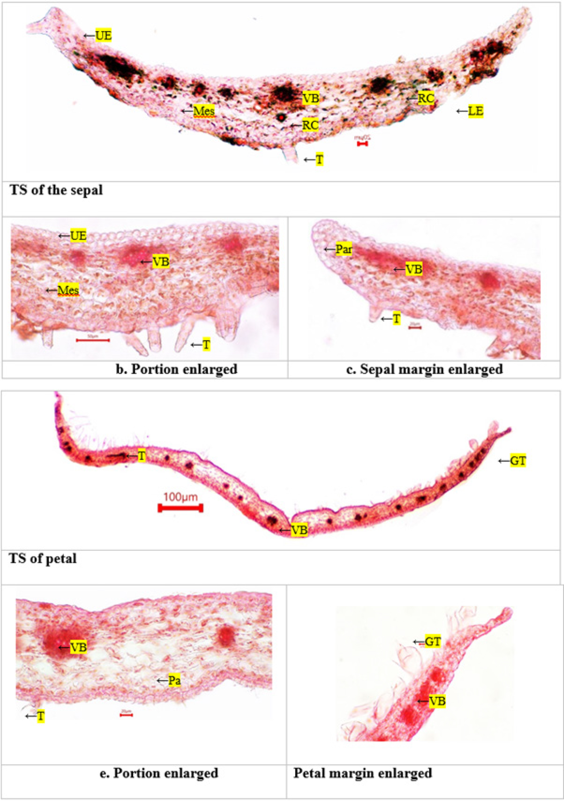 TS ofPergularia daemia sepal and petal. Col - collenchyma; Cu - cuticle; E - epidermis; GT - ground tissue; Pa - parenchyma; Ph - phloem; Pi -pith; T - trichome; V - vessel; VB - vascular bundle.