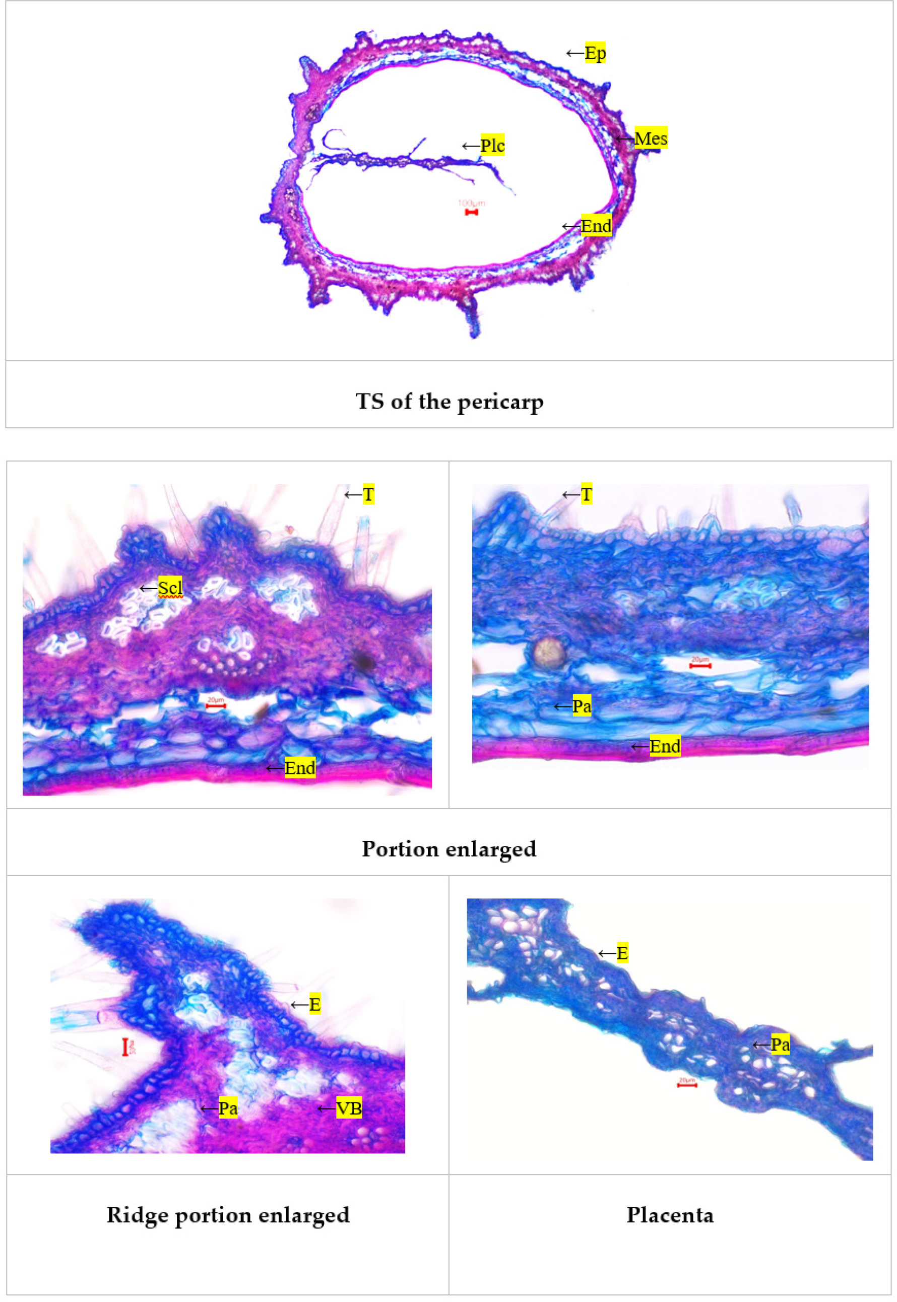 TS of Pergularia daemia Pericarp. E - epidermis; Ep - epicarp; End-endocarp;Mes - mesocarp; Pa - parenchyma; PCr - prismatic crystal; Plc - placenta; Scl - sclereids; T -trichome; Te - testa; VB - vascular bundle.