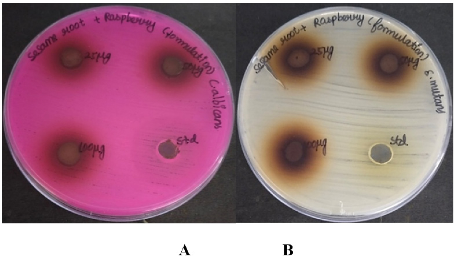 Antimicrobial activity of raspberry and sesame root herbal formulation using agar well diffusion technique against oral pathogens A) C. albicans B) S. mutans.