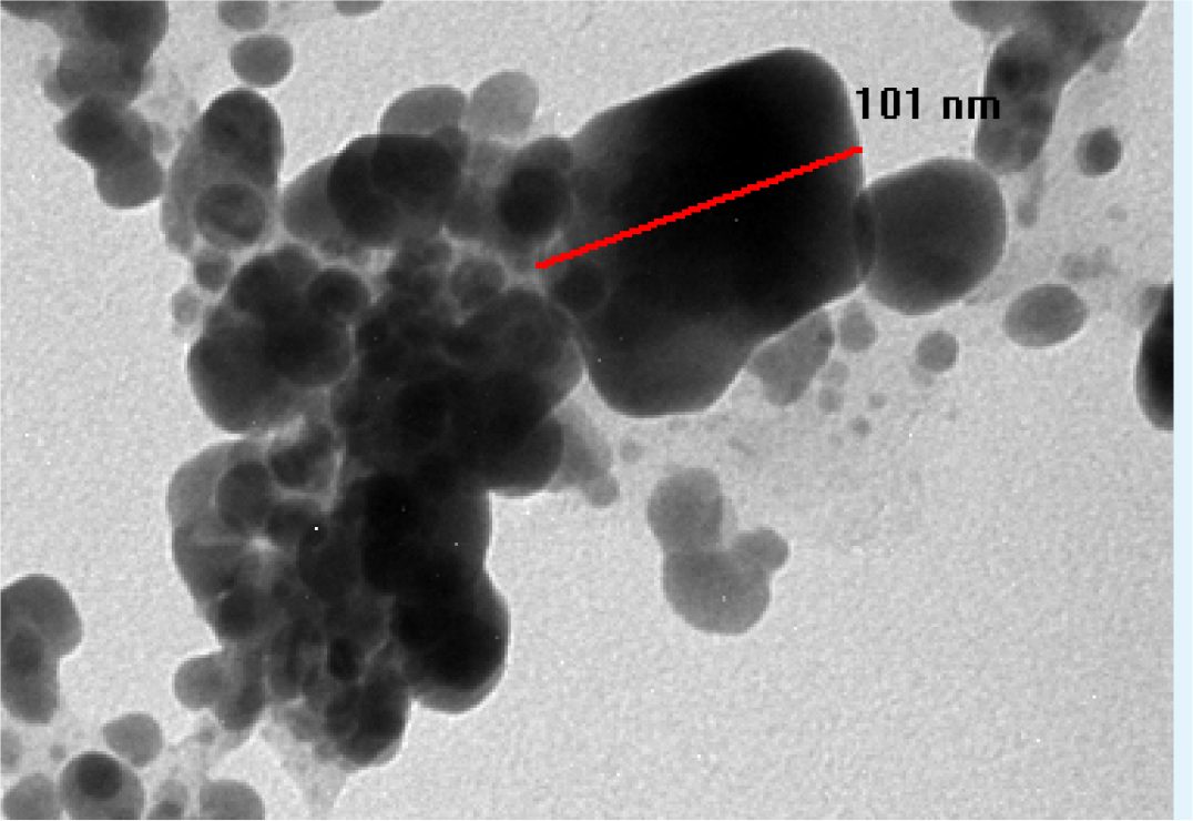 TEM analysis of phytosome.