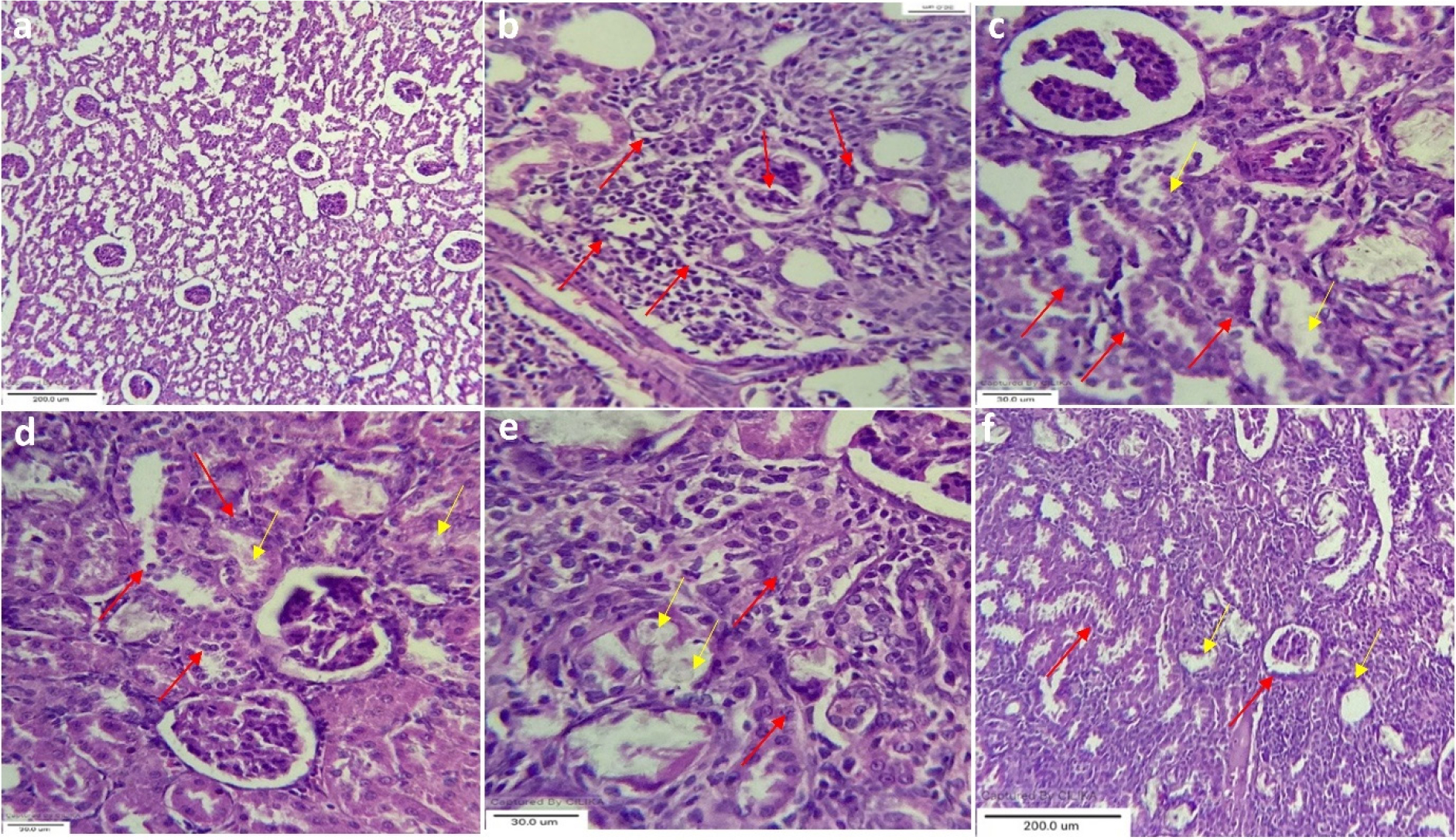 Microphotographs of Histopathology of kidney (a) Norm al group, (b) Disease control group showed crystal deposition having large size, (c) Standard group (Cystone (750 mg/kg) treated), (d) Treatment group I (250 mg/kg TC), (e) Treatment group II (500 mg/kg TC) and (F)Treatment group III (250 mg/kg TCP).