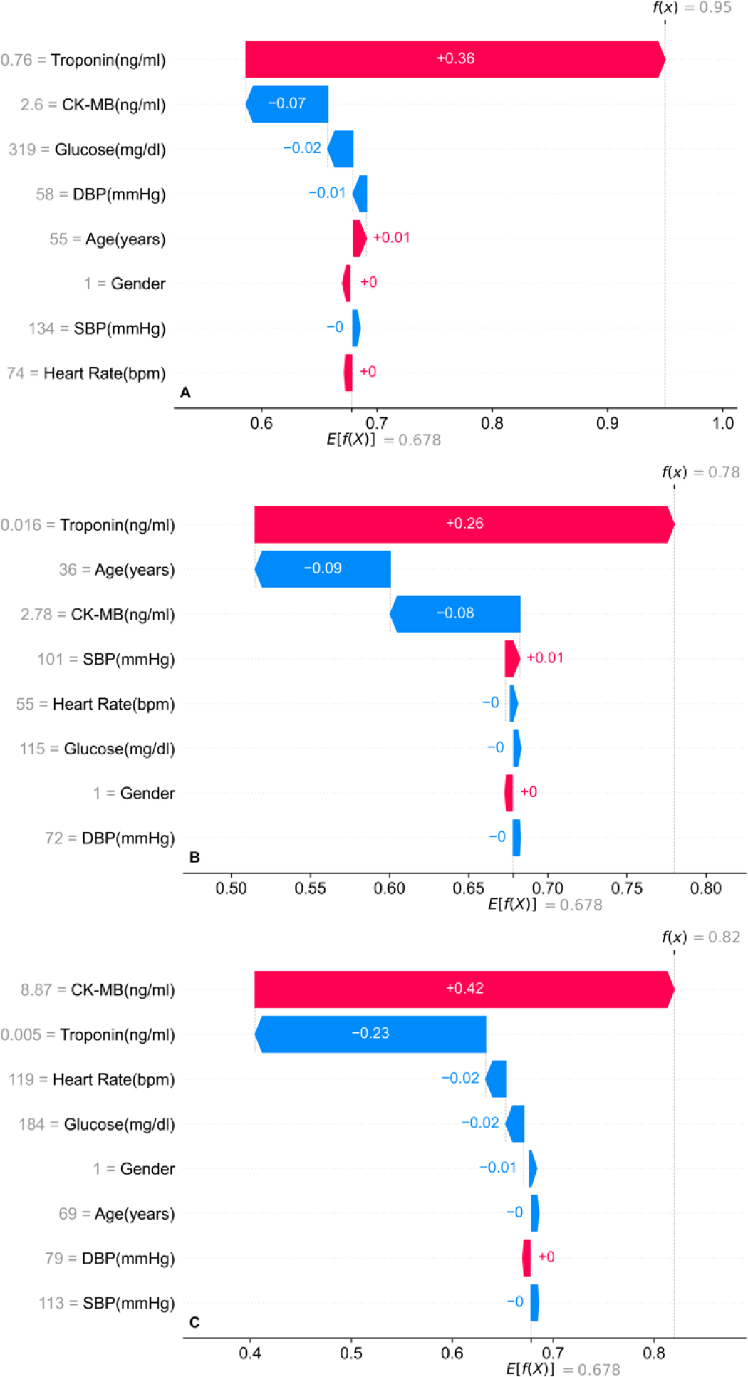 SHAP Waterfall plot for Individual Patient with normal Troponin and experienced MI. Troponin and systolic blood pressure contribute positively despite normal biomarker values, while age and CK-MB show minor protective effects (Reproduced at column width).