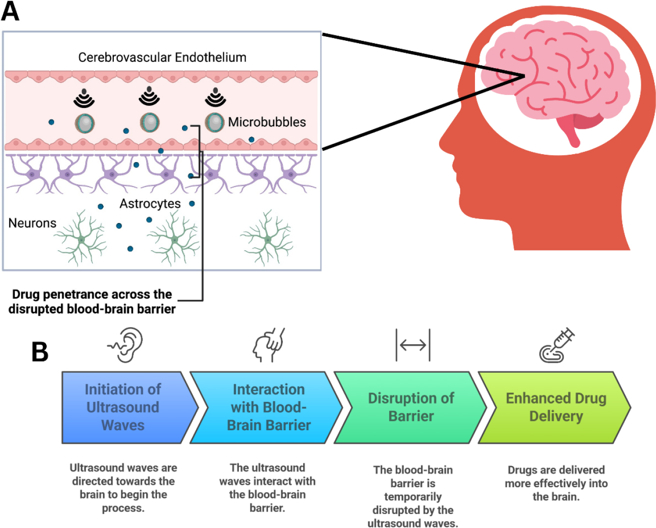 Ultrasound-mediated disruption of the Blood-Brain Barrier (BBB) enhances drug delivery to the brain. (A) Key components of the cerebrovascular endothelium, including microbubbles, astrocytes, and neurons, are involved in BBB modulation. Licensee MDPI, Basel, Switzerland. (B) Process of ultrasound wave application and interaction with the BBB, leading to temporary disruption and improved drug penetration into brain tissue.