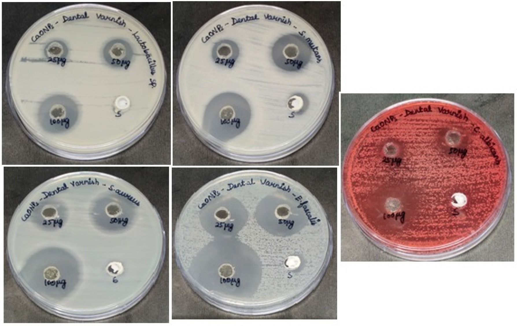 Antimicrobial activity of Hedyotis diffusa mediated calcium oxide nanoparticles against clinical pathogens E. faecalis, S. aureus, S. mutans, Lactobacillus sp., and C. albicans.