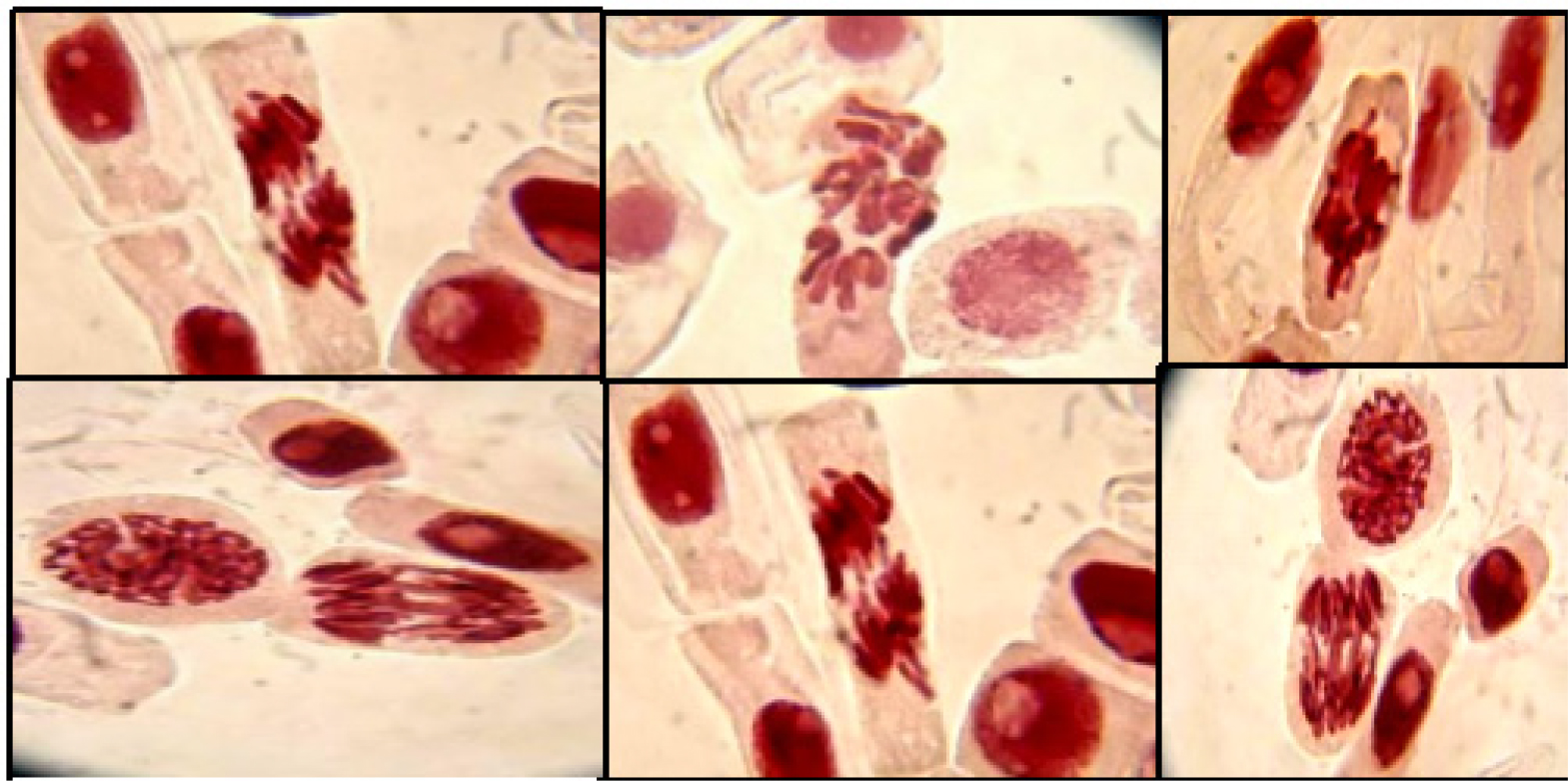 Chromosomal aberrations observed in root tip cells of Allium cepa. 1. AnB 2. MuB 3. AnB 4. AnCC 5. TeV 6. PoD. *AnB-Anaphase bridge: *MuB-multiple bridges: *AnB-Fanaphase bridge and fragments. *AnCC-criss-cross at anaphase: *TeV-telophase with vagrant chromosome *PoD-polar deviation. *[Picture taken through Fapiwen Telescope with Smart phone adapter mount].