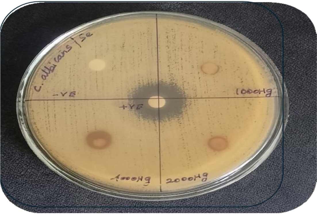 Disc diffusion assay showing Anti-fungal activity of Senna auriculata.