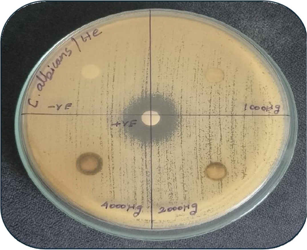 Disc diffusion assay showing Anti-fungal activity of Lawsonia inermis.