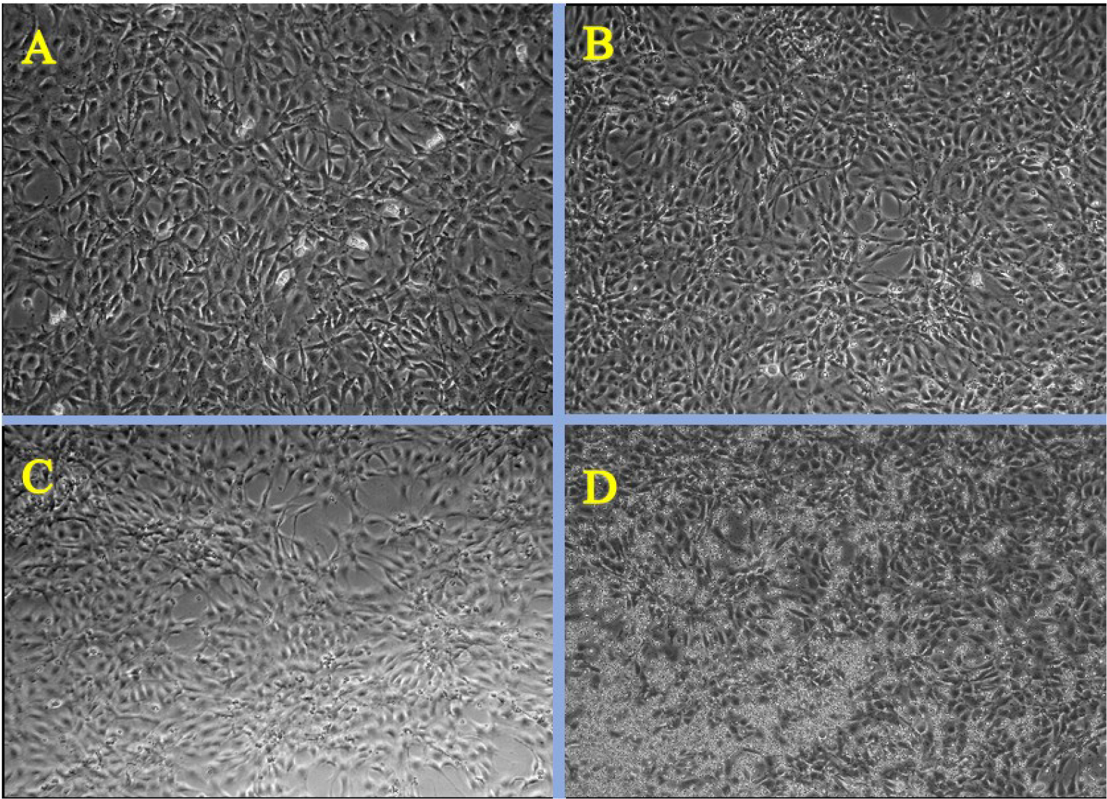 Phase contrast microscopy images of Citrus reticulata mediated hydroxy apatite nanoparticles at different concentrations A) control B) 3.175 µg/mL C) 25 µg/mL D) 200 µg/mL.